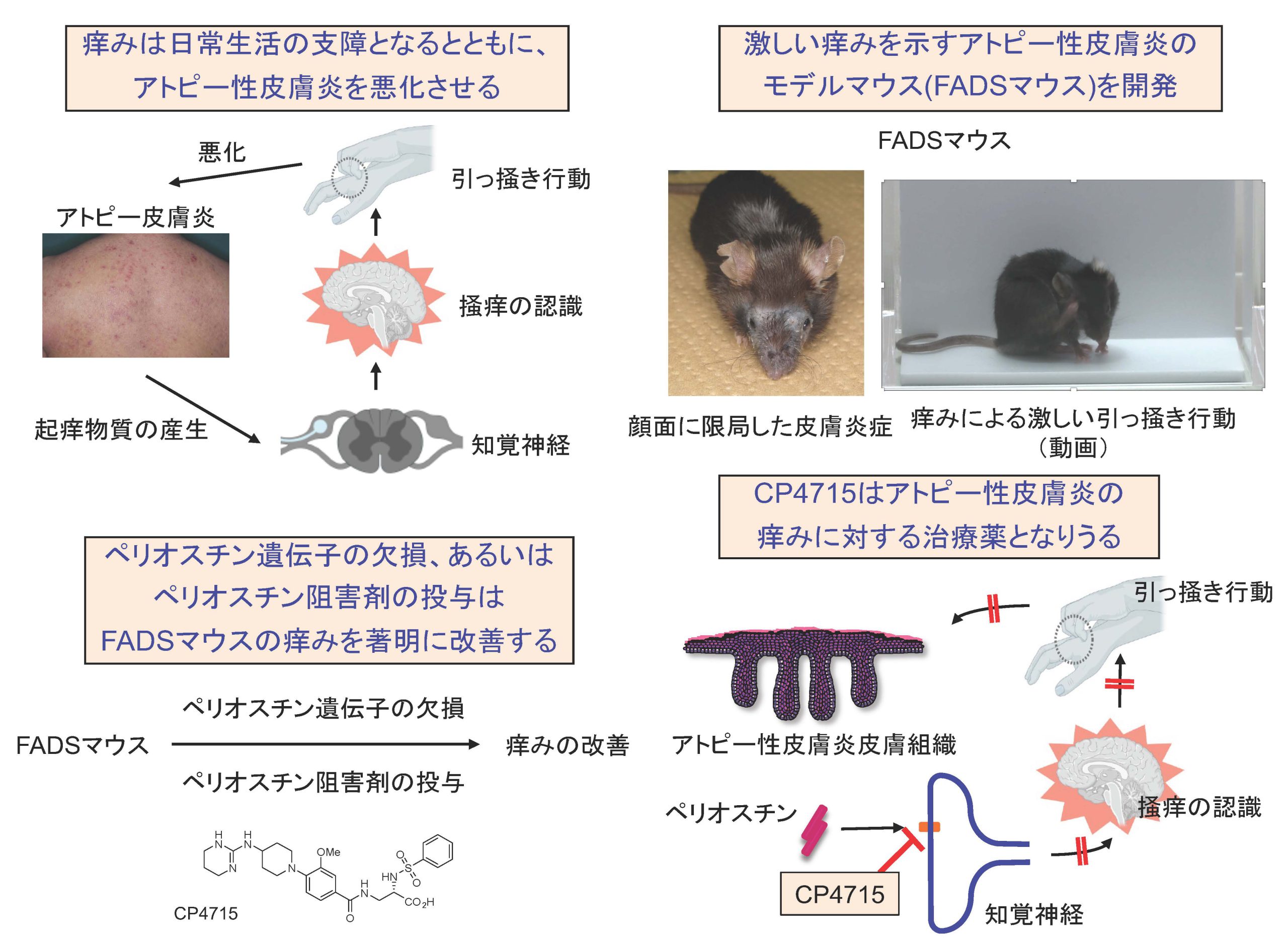 出原教授らのグループがアトピー性皮膚炎の痒みの原因を解明するとともに、その阻害剤を発見